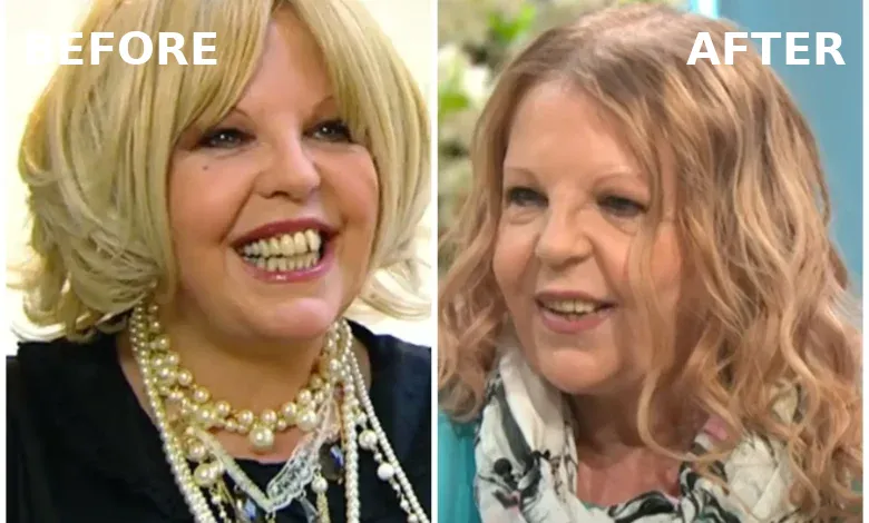 Sally Thomsett Face Illness